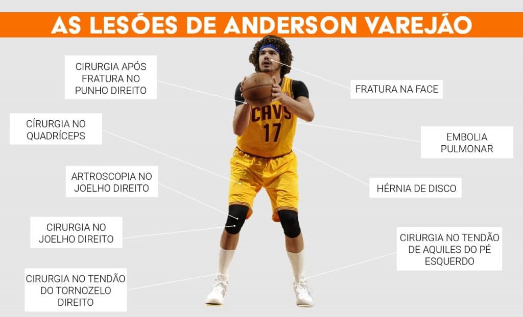 Lesões mais graves de Anderson Varejão na carreira